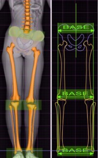 Diagram representing the concept of Base