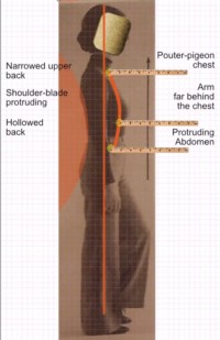 The model of correct upright gesture in the modern AT is displaying many defects which the AT was supposed to eradicate.