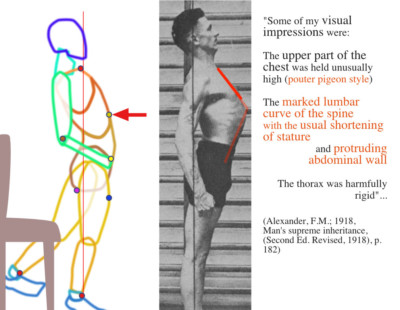 Diagram comparison between F.M. Alexander's illustration and the diagram of the subject walking backward.